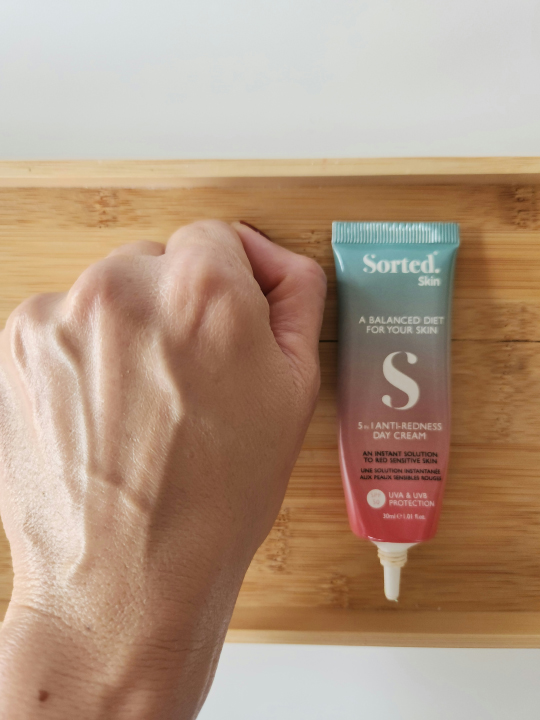 sortedskin porovnanie zelenych kremov